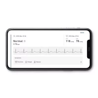 OMRON Complete 2 az 1-ben okos vérnyomásmérő és EKG
