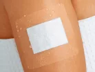 CURAPOR transparent, átlátszó steril szigetkötszer 10 x 8cm (25db/cs)