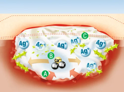 SUPRASORB A+Ag  antimikrobiális kálcium-alginát kötszer ezüsttel 5 x 5 cm