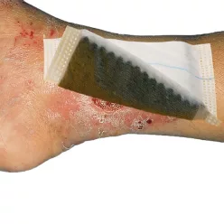   VLIWAKTÍV Ag Aktívszenes tampon ezüsttel impregnálva 6,5 x 10cm