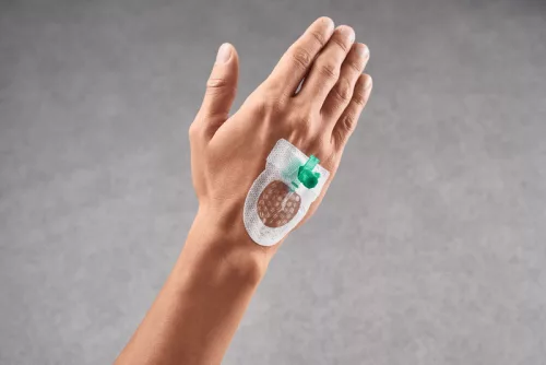 Curafix i.v. Control (5,5 x 6,5 cm) steril kontrollablakos kanülrögzítő tapasz