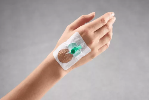 Curafix i.v. Control (6 x 7,5 cm) steril kontrollablakos kanülrögzítő tapasz