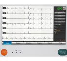 EKG készülék HeartScreen 210 / 12 csatornás, billentyűzettel