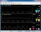 veroxigen-szint-mero-pulzusmero-pulse-ocimeter