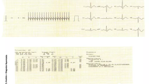 EKG készülék HeartScreen 80GL1