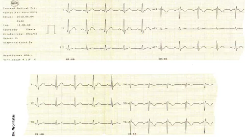 EKG készülék HeartScreen 80GL1