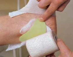 Komprex 0 habgumi vese alakú 22301