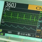 Bifázisos defibrillátor CardioAid™ 360B