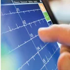 MORTARA ELI 280 12 csatornás EKG készülék