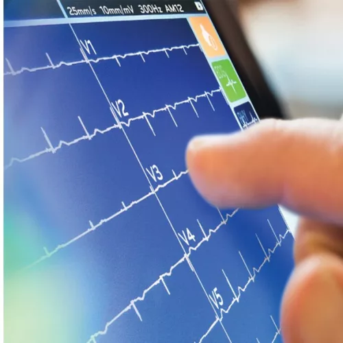 MORTARA ELI 280 12 csatornás EKG készülék