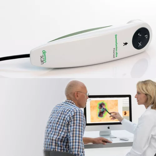DERMOGENIUS ULTRA VIDEODERMATOSZKÓP - Termék MoleExpert Micro