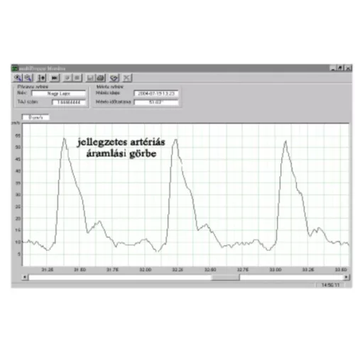 Orvosi érdoppler MultiDoppy PC kapcsolattal - Fej 8 MHz