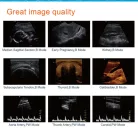 Termék Trans-Vaginalis 6.0 MHz