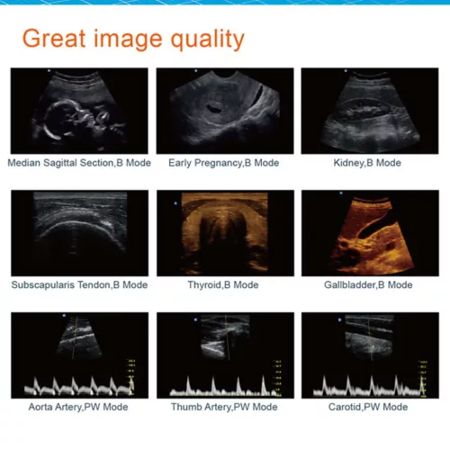 Termék Trans-Rectalis 7.5 MHz