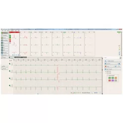 BTL CardioPoint Holter H100 szet