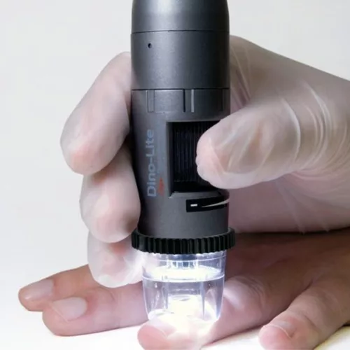 DinoLite CapillaryScope 500 PRO kapilláris mikroszkóp