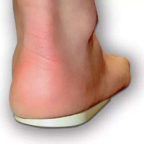 Valgus / pronációs korrekciós talpbetét 2231