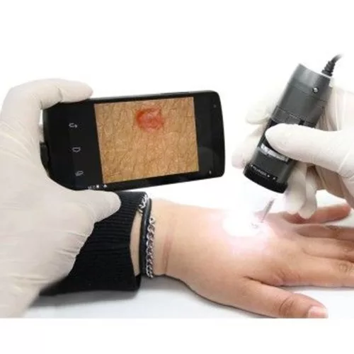 DermaScope digitális dermatoscop  polarizációs, 1050x, 1,3 Mpix