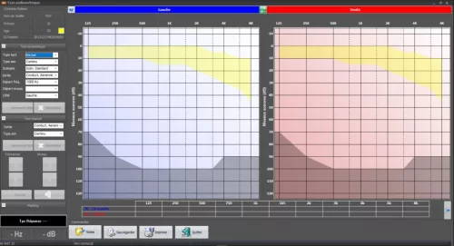 Szűrőaudiometer 800M számítógépes