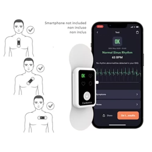 CARDIONICA 1 csatornás EKG készülék AFIB funkcióval