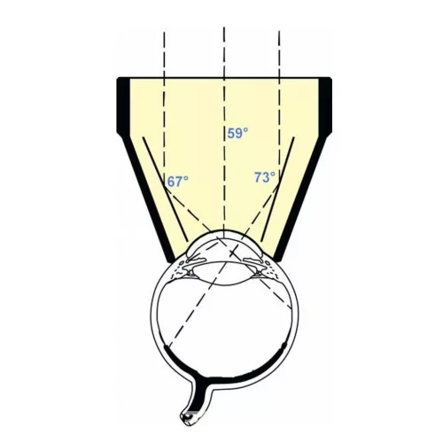 Ocular Instruments OG3M 3 Mirror Universal hármastükör, 18mm OD