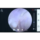 Riester RCS100 kamera rendszer - Termék dermatoscop lencse