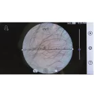 Riester RCS100 kamera rendszer - Termék általános lencse