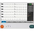 EKG készülék HeartScreen 210 / 12 csatornás, billentyűzettel - Termék szoftver PC