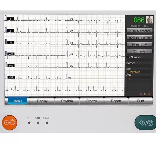 EKG készülék HeartScreen 210 / 12 csatornás, billentyűzettel - Termék szoftver PC