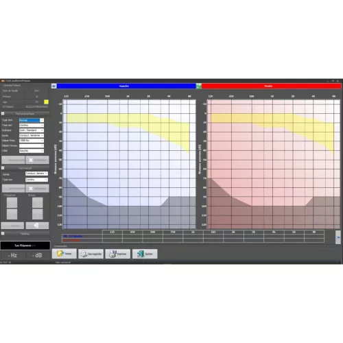 Szűrőaudiometer 820M számítógépes csontvezetéssel
