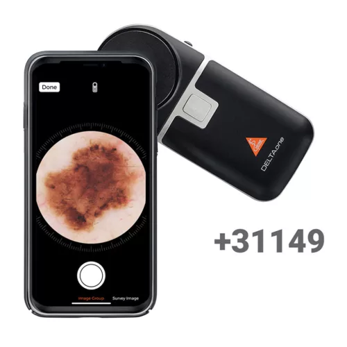 Heine univerzális telefon adapter K000.34.273