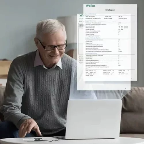Viatom ER1LW 24 órás EKG holter