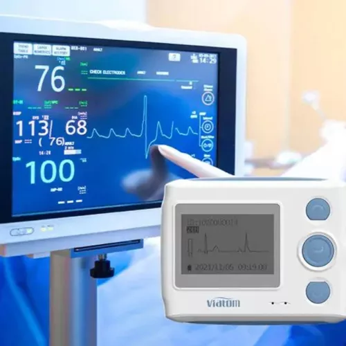 Viatom TH12 12 elvezetéses 24 órás mini EKG holter monitor