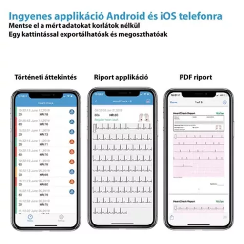 Viatom Pulsebit EX személyi EKG