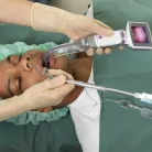 AMBU KING VISION video laryngoscop - Termék 2-es gyerek stand lapoc 20db