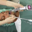 AMBU KING VISION video laryngoscop - Termék 3-as csatornás felnőtt lapoc 20db