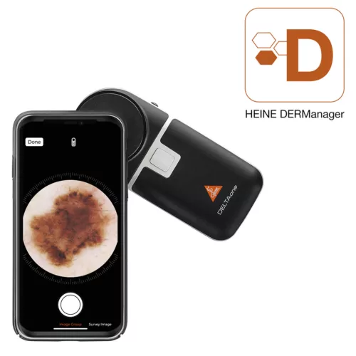 HEINE DELTAone dermatoscop fekete/ezüst - Szín fehér/ezüst