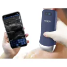 VIATOM lineáris vezeték nélküli orvosi ultrahang 7.510 MHz