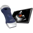 VIATOM lineáris/convex vezeték nélküli orvosi ultrahang 7.510 MHz / 3.55 MHz