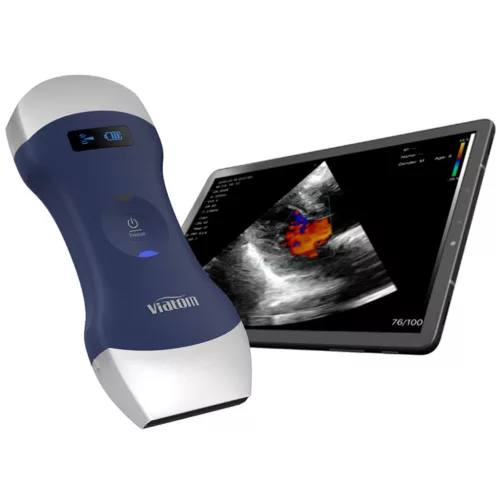 VIATOM lineáris/convex vezeték nélküli orvosi ultrahang 7.510 MHz / 3.55 MHz