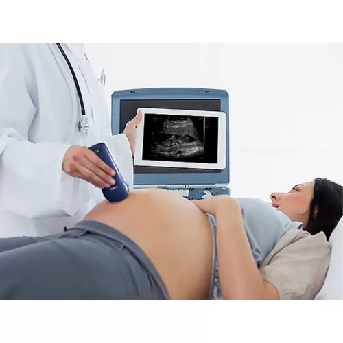 VIATOM lineáris/convex/cardialis vezeték nélküli orvosi ultrahang 7.510 MHz / 3.55 MHz / 2.55 MHz