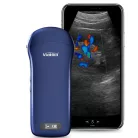 VIATOM lineáris/convex/cardialis vezeték nélküli orvosi ultrahang 7.510 MHz / 3.55 MHz / 2.55 MHz