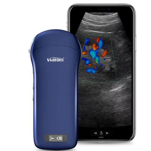VIATOM lineáris/convex/cardialis vezeték nélküli orvosi ultrahang 7.510 MHz / 3.55 MHz / 2.55 MHz