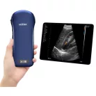 VIATOM lineáris/convex/cardialis vezeték nélküli orvosi ultrahang 7.510 MHz / 3.55 MHz / 2.55 MHz