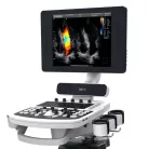 Ultrahang készülék CHISON QBit5 colordoppler 15' + kocsi - Termék gyermek fej 5 MHz