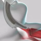 Dahlhausen Video Laryngoscop   egyszer használatos lapocokkal