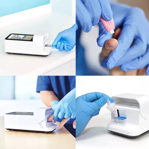 LumiraDX POC kislabob készülék (CRP, Ddimer, INR, HgA1c, NTproBNP) - Méret D-dimer teszt 12db