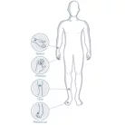 SUNLIGHT MINIOMNI ultrahangos csontrikulás szűrő gép (fej + szoftver)