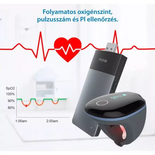 Viatom O2 Ring – Pulzoximéter gyűrű - Alvási apnoe wifi Remote linker (távfelügyelet)