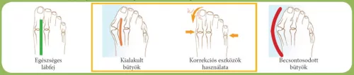 QMED harántemelő párna, kicsi, 1 pár